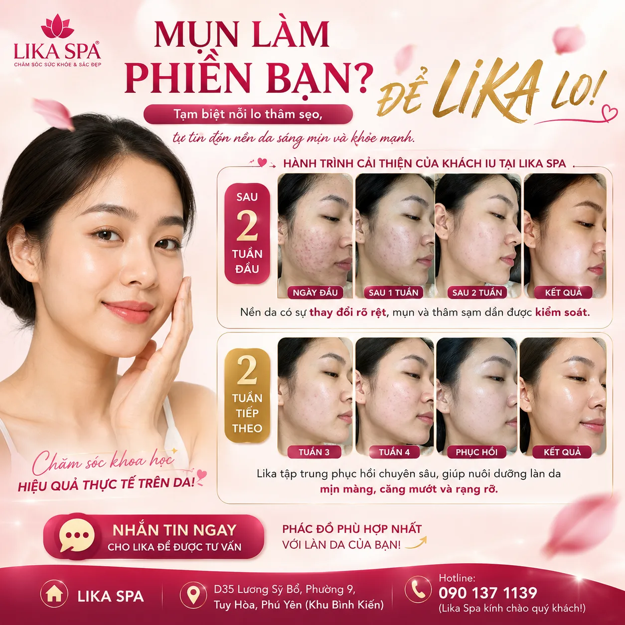 Thiết kế thương hiệu Banner Lika Spa cải thiện da mụn chuyên nghiệp